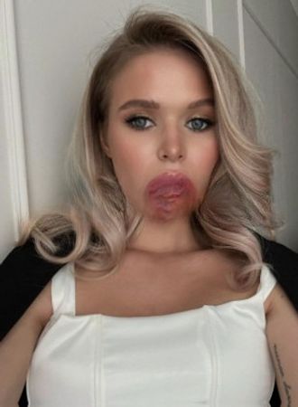 Vika